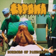 LIPOMA - CD - Horrors of Pathology
