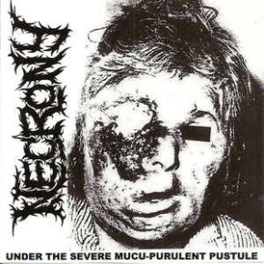 NECRONY -2CD- under the severe mucu-purulent pustule